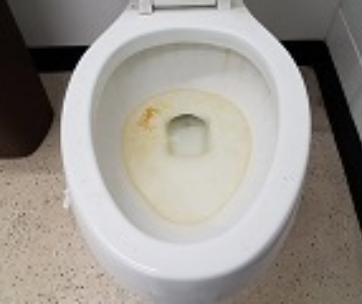 Effective Ways To Get Rid of Toilet Rings