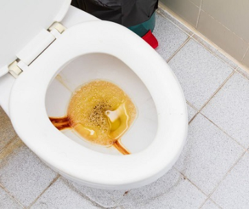 How To Solve Common uric acid problems (toilet related)
